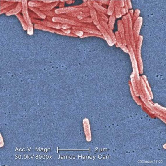 Legionella Pneumonia Lawsuit Compensation
