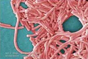 Legionella Pneumonia Outbreak and Legionnellosis Infection