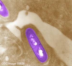 Listeria monocytogenes