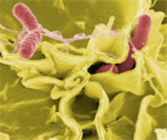 Salmonella Lawsuit