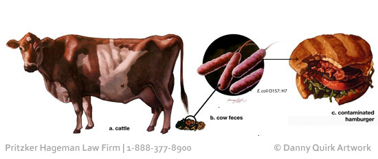 E coli O157