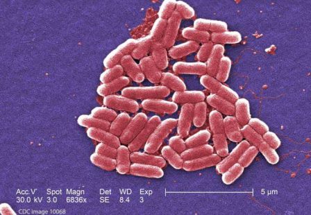 E. coli lawyer - CDC image of E coli bacteria