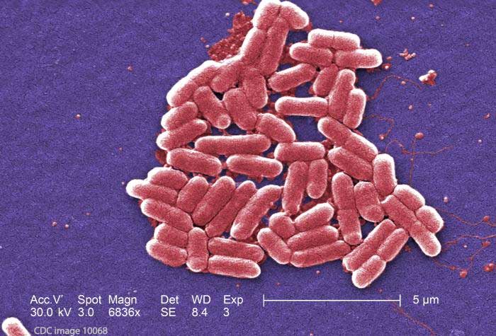 E. coli lawyer - CDC image of E coli bacteria