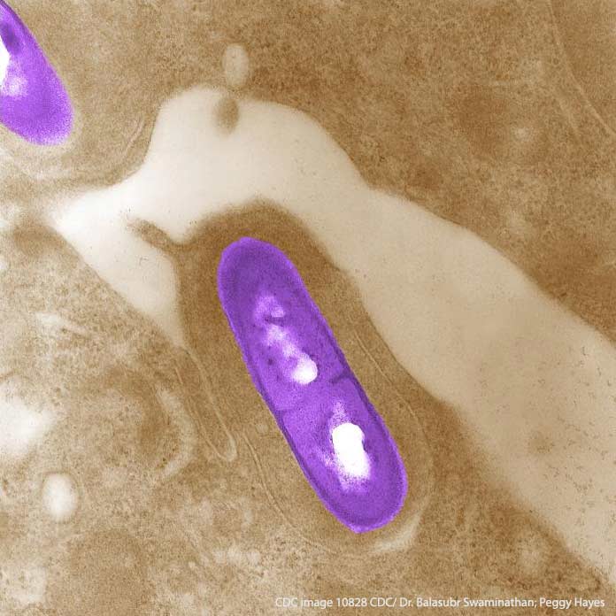 Listeria monocytogenes bacteria from CDC