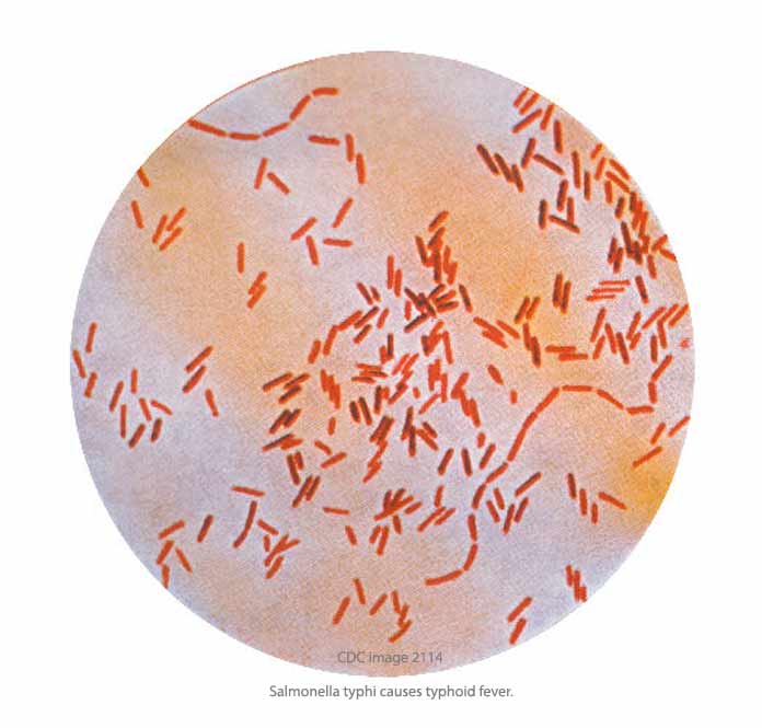 Salmonella Typhi - Typhoid Fever