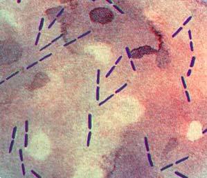 clostridium perfringens in food