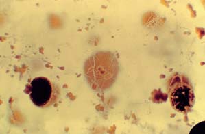 Aspergillus