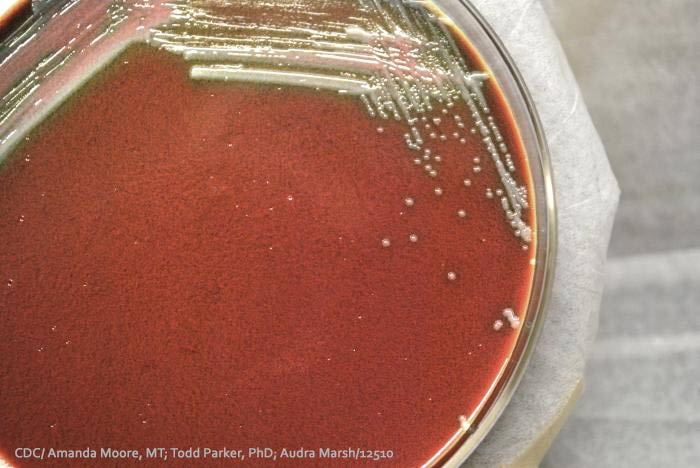 Bacteria in Petri Dish