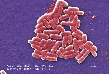 E. coli Bacteria