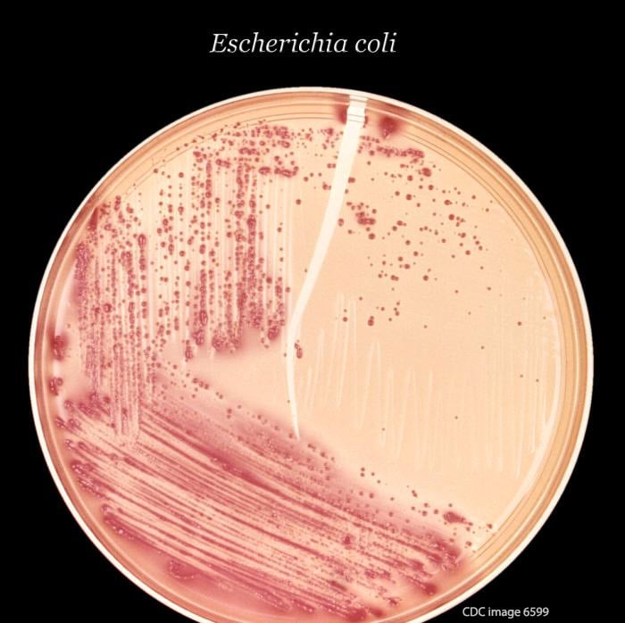 E. coli Testing