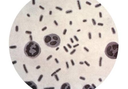 Klebsiella Bacteria