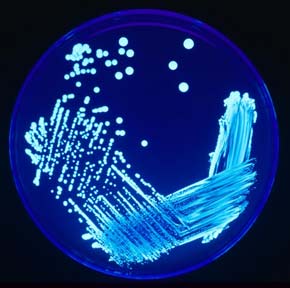 Legionella bacteria is tested to determine source of pneumonia.