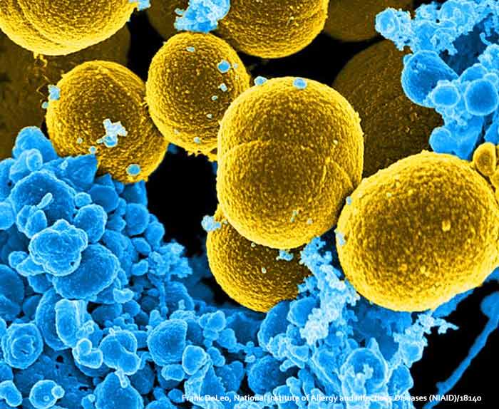 Staphylococcus