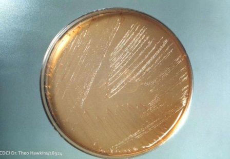 Bacteria Test Agar