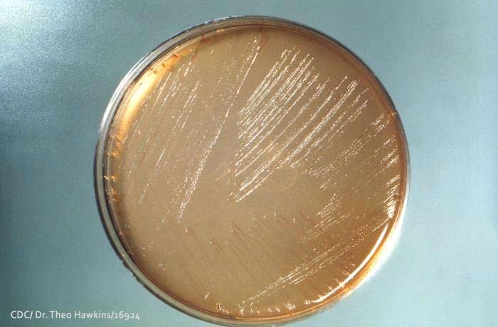 Bacteria Test Agar