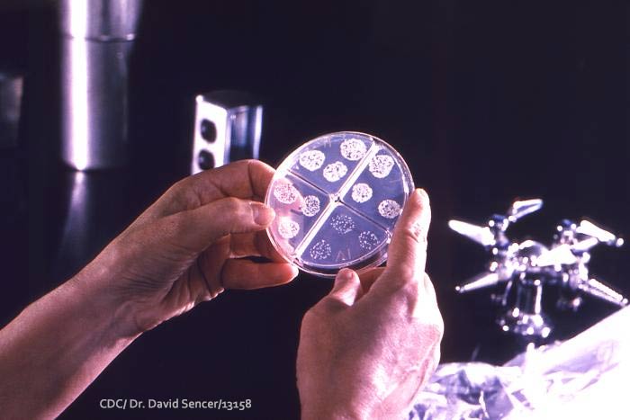 Bacteria Test on Quad Plate