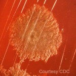 Clostridium Botulinum from the CDC