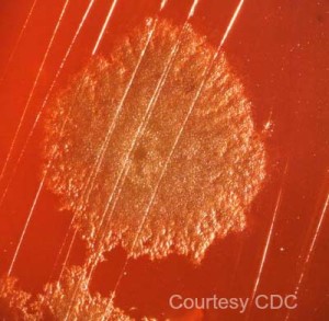 Clostridium Botulinum from the CDC