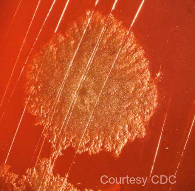 Clostridium Botulinum from the CDC