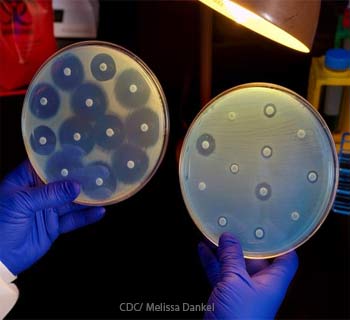 Bacteria in Petri Dish Testing