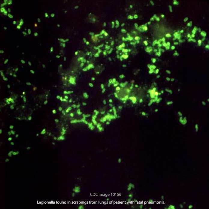 Legionella and Fatal Legionnaires Pneumonia