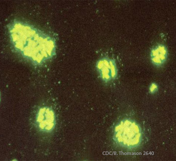 Salmonella Bacteria Green