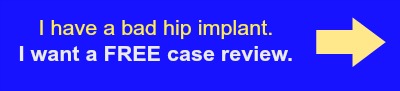 Hip Free Case Review