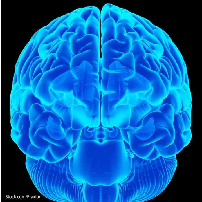 Image of Brain TBI