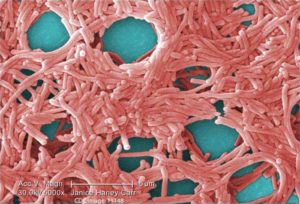 Legionella Bacteria