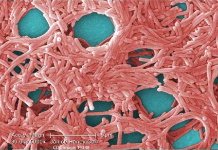 Legionella Bacteria