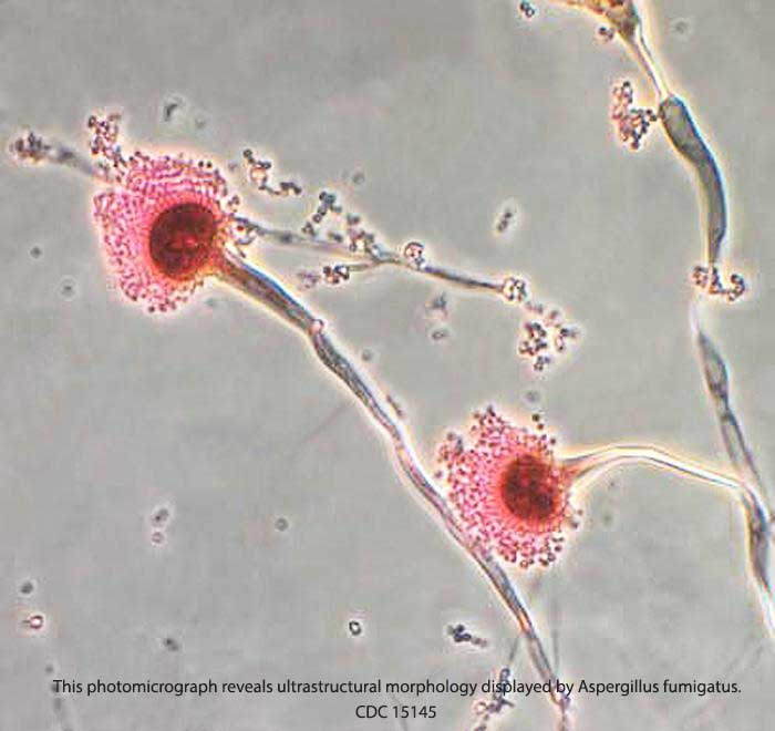 Aspergillus Fungi