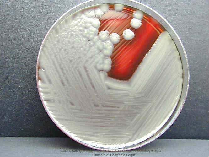 Example of Bacteria on Agar - CDC Image