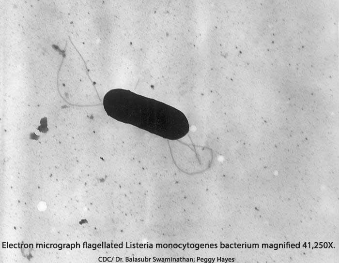Listeria Bacteria Cause Listeriosis
