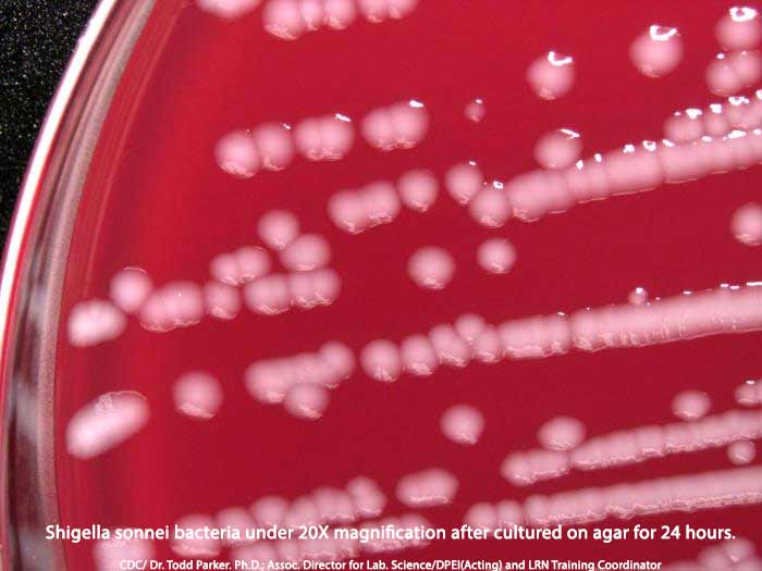 Shigella Bacteria Cause Shigellosis