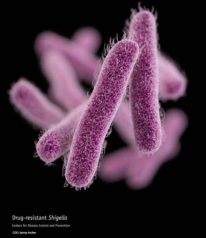 Shigella - Antibiotic Resistant