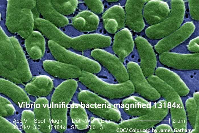 Vibrio Bacteria Cause Vibriosis