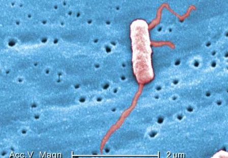 Legionella Bacteria with Flagella