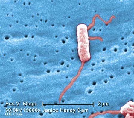 Legionella Bacteria with Flagella