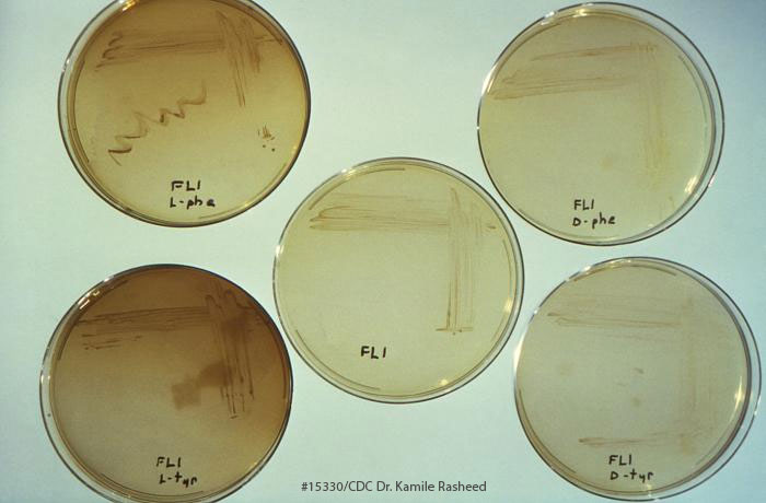 Legionella Pneumophila Testing