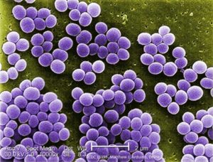 Staphylococcus aureus Infection