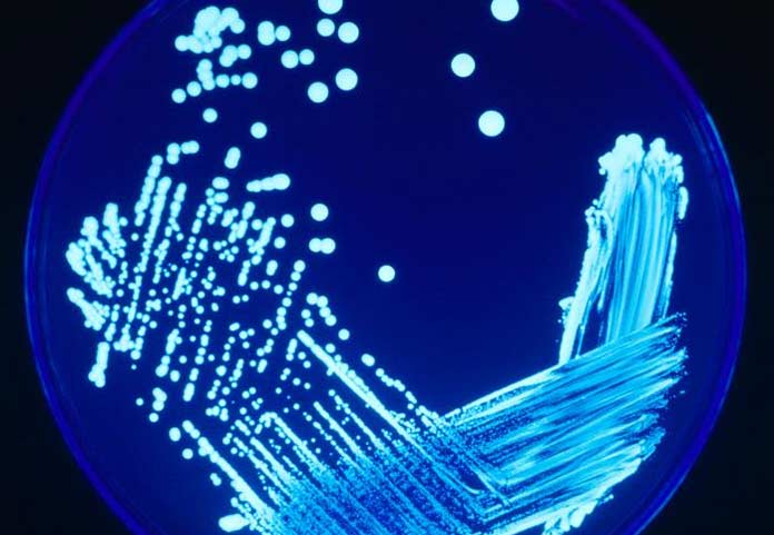 Legionella Bacteria Test