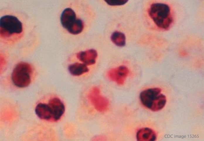 Legionella in Lungs