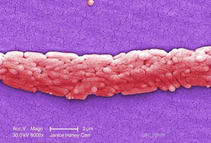 Salmonella Magnified 8000 Times