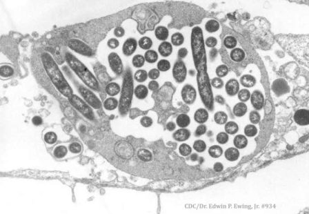 Legionella Pneumophila in Lung Tissue