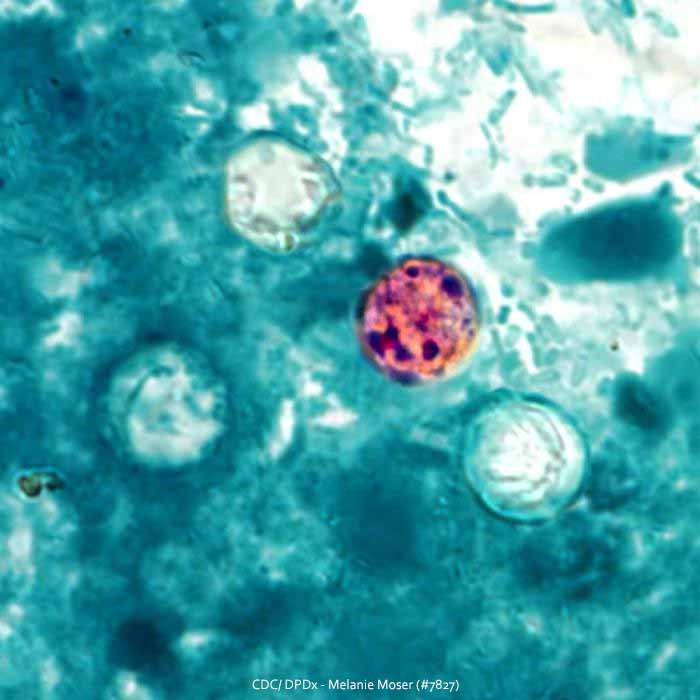 Cyclospora