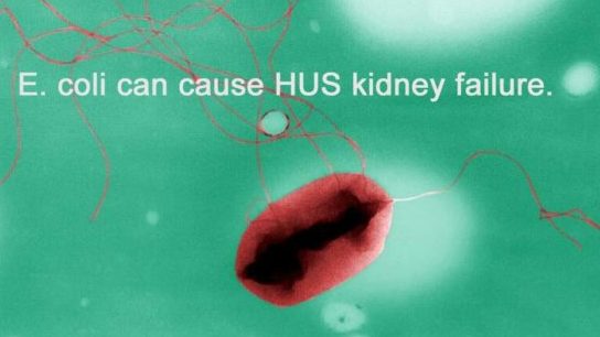 E. coli HUS Kidney Failure