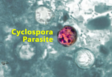 Cyclospora Parasite