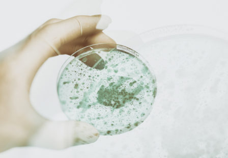 Listeria Lawyer- Laboratory Gloved Hand Holding a Petri Dish