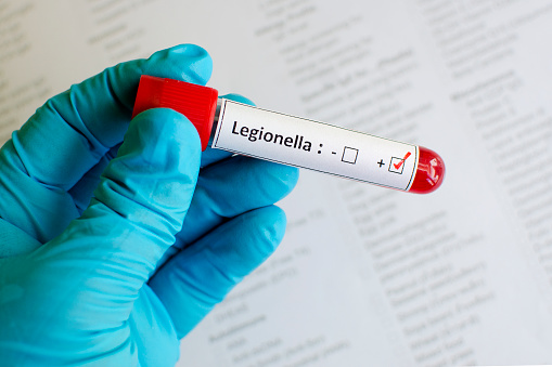 Test tube marked "Legionella," Legionnaires' disease outbreak at Duke 