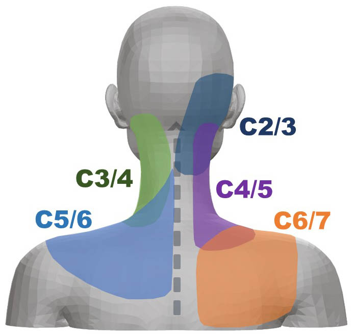 Neck Pain Map